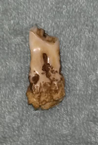 tooth3_zpsoajvsawt.gif