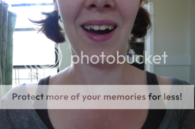 My Teeth 2010