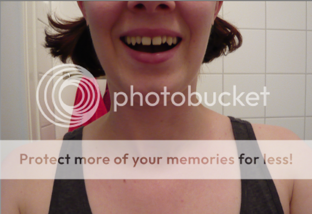 After Homeoblock Use 2011