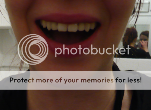 Temporary teeth