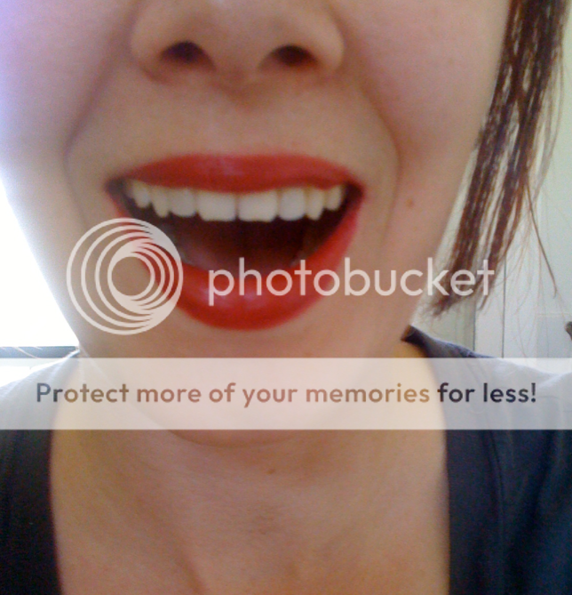 Final fake teeth